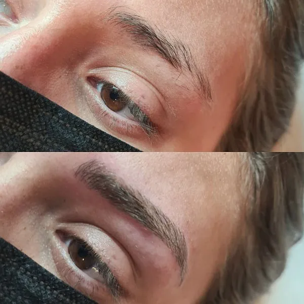 micro needling sourcils